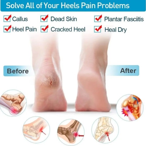 Heel Protective Cover